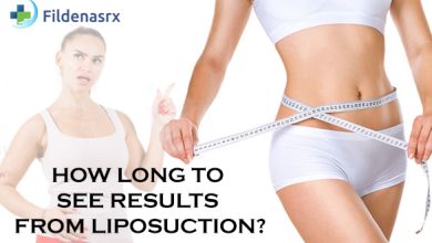 How Long To See Results From Liposuction?