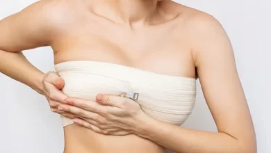 Breast Augmentation